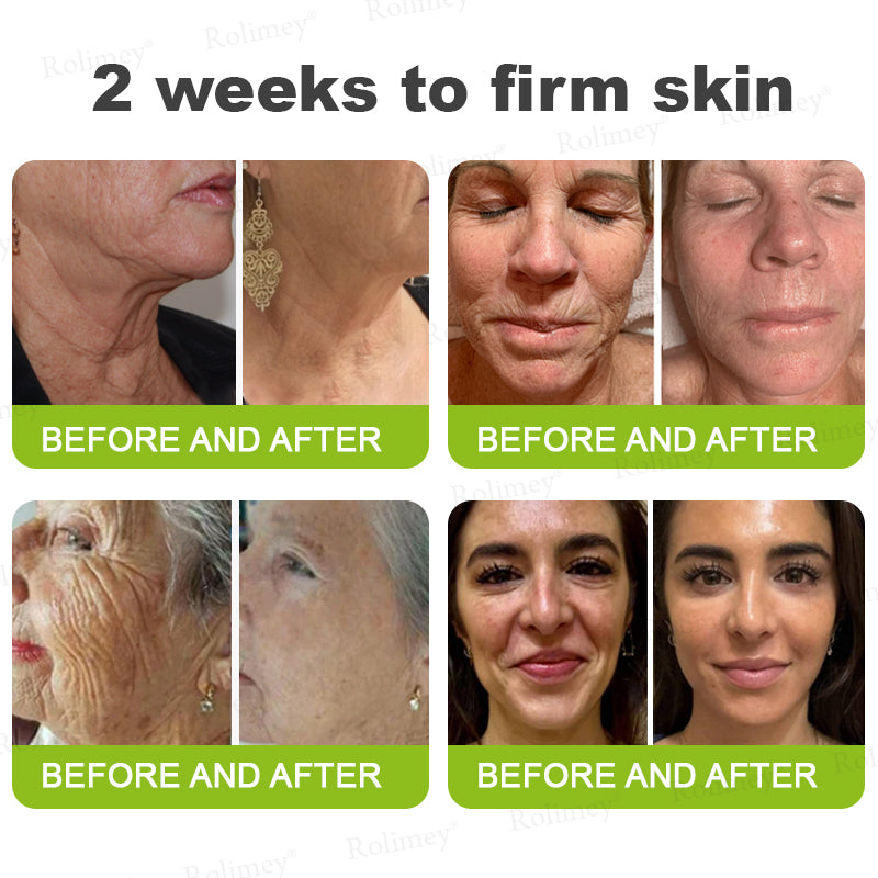 🍈Rolimey® Botox & Vita-A Retinol Shot Wrinkle-Lift Tightening cream - Last Day Promotion 70% OFF