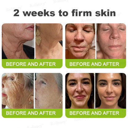 🍈Rolimey® Botox & Vita-A Retinol Shot Wrinkle-Lift Tightening cream - Last Day Promotion 70% OFF