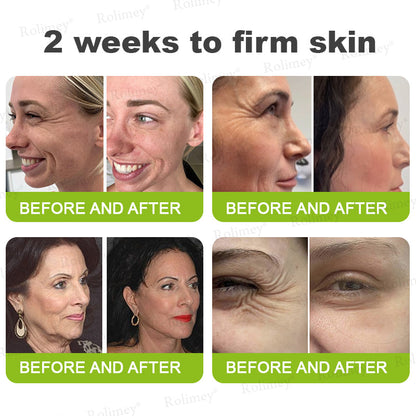🍈Rolimey® Botox & Vita-A Retinol Shot Wrinkle-Lift Tightening cream - Last Day Promotion 70% OFF