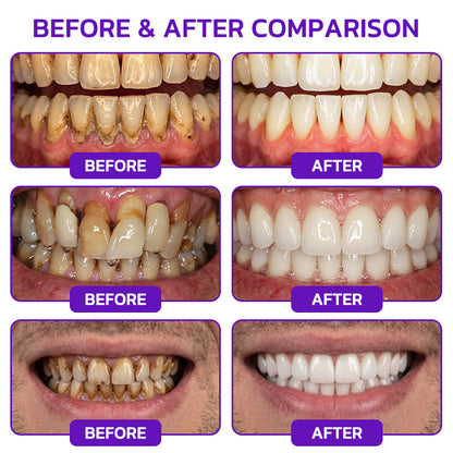 Rolimey® VioCore Bee Venom Gingivitis & Periodontitis Treatment Toothpaste