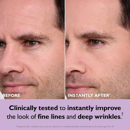 🔥Last Day 70% OFF🔥Instant Firming Temporary Face Tightener Easy-Wear Formula
