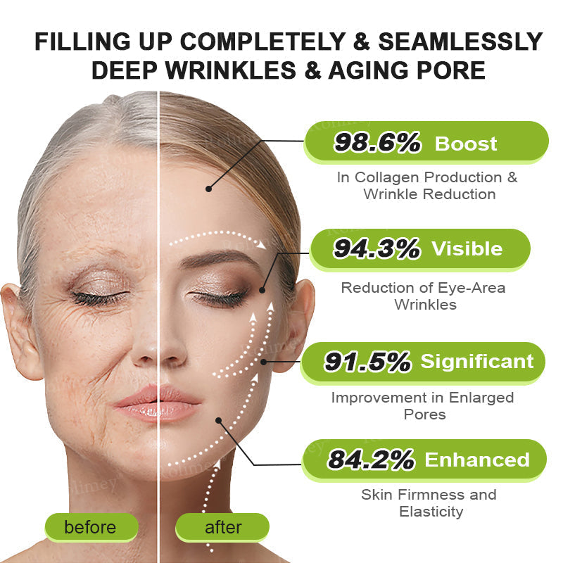 🍈Rolimey® Botox & Vita-A Retinol Shot Wrinkle-Lift Tightening cream - Last Day Promotion 70% OFF