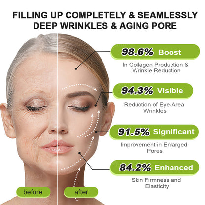 🍈Rolimey® Botox & Vita-A Retinol Shot Wrinkle-Lift Tightening cream - Last Day Promotion 70% OFF