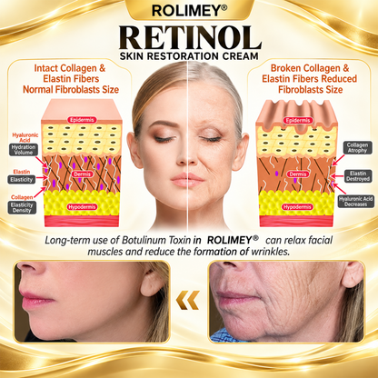 🎁2026 New Rolimey® Retinol Advanced Skin Restoration Cream | Botox-Inspired Firming & Smoothing Care for All Skin Types