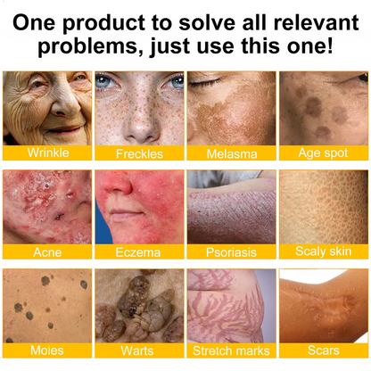 🎁💎 Rolimey® Bee venom Pro Comprehensive Cream —Tightening for Skin Types 🔥