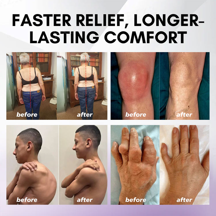 👨‍⚕️🦴Rolimey® Turmeric & Emu Oil Arthritis Soothing Pain Relief Massage Gel🛡️