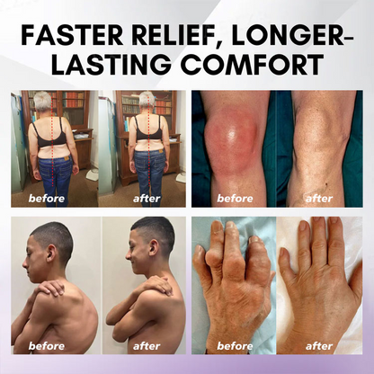 👨‍⚕️🦴Rolimey® Turmeric & Emu Oil Arthritis Soothing Pain Relief Massage Gel🛡️