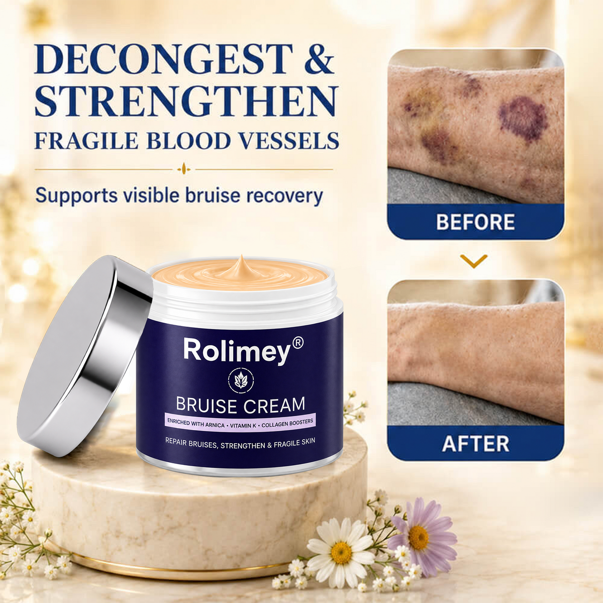 💕 2026 Best-Selling Skin Care | Rolimey® Bruise Care Cream | Advanced Care for Fragile, Aging & Bruise-Prone Skin