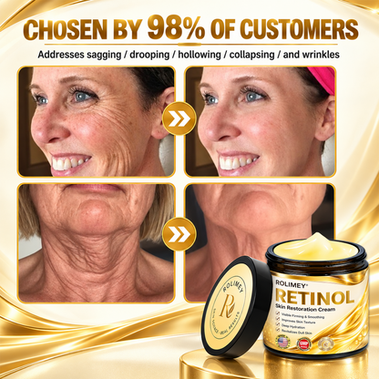 🎁2026 New Rolimey® Retinol Advanced Skin Restoration Cream | Botox-Inspired Firming & Smoothing Care for All Skin Types