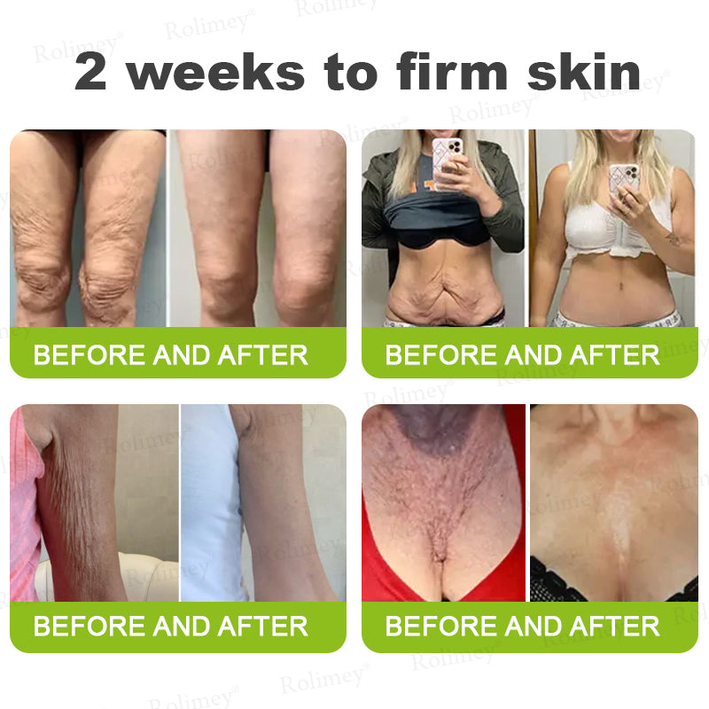 🍈Rolimey® Botox & Vita-A Retinol Shot Wrinkle-Lift Tightening cream - Last Day Promotion 70% OFF