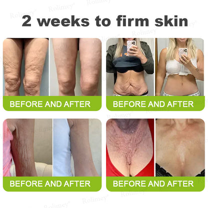 🍈Rolimey® Botox & Vita-A Retinol Shot Wrinkle-Lift Tightening cream - Last Day Promotion 70% OFF