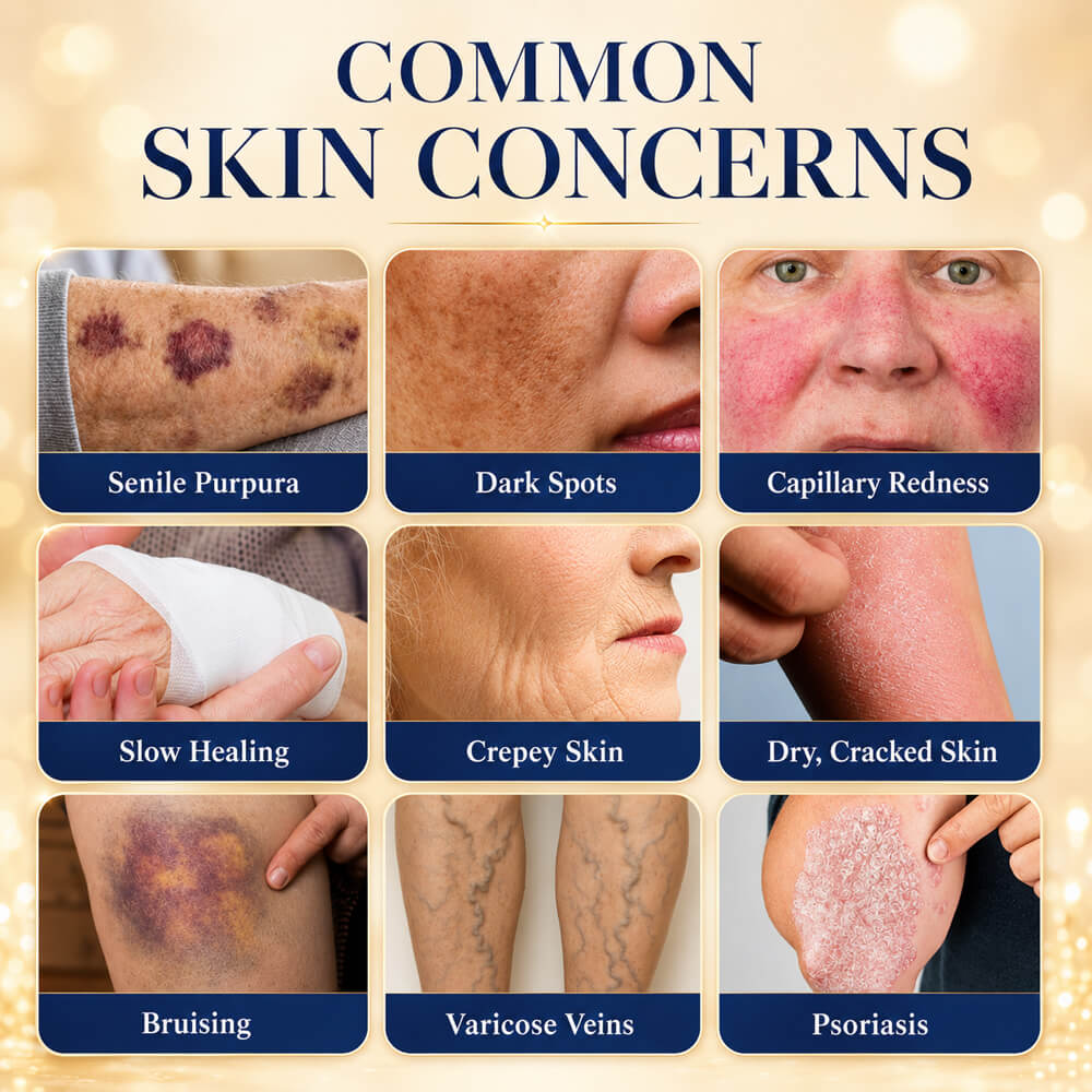 💥 2026 Best-Selling Skin Care | Rolimey® Bruise Care Cream | Advanced Care for Fragile, Aging & Bruise-Prone Skin