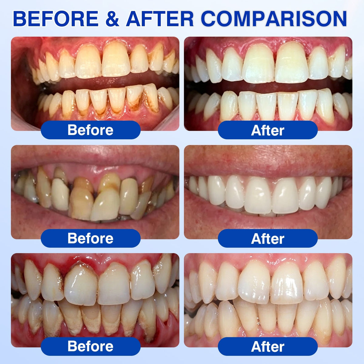 🎁🦷GumRevive Periodontal Repair Gel🛡️