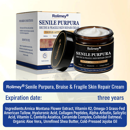 💥 2026 Best-Selling Skin Care | Rolimey® Bruise Care Cream | Advanced Care for Fragile, Aging & Bruise-Prone Skin
