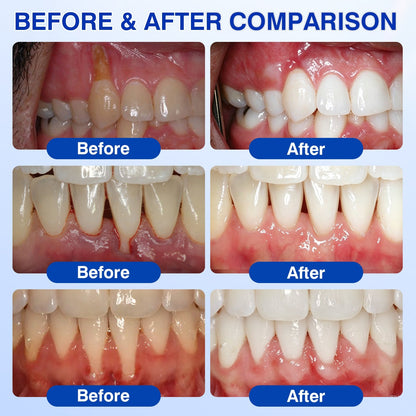 🎁🦷GumRevive Periodontal Repair Gel🛡️