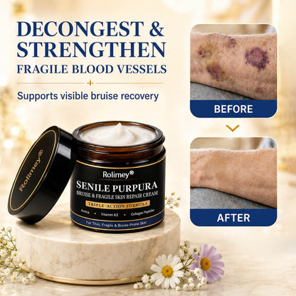 💥 2026 Best-Selling Skin Care | Rolimey® Bruise Care Cream | Advanced Care for Fragile, Aging & Bruise-Prone Skin