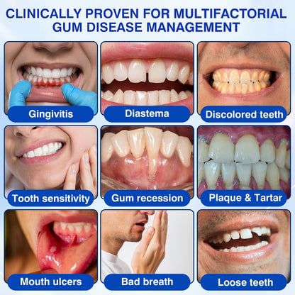 🎁🦷GumRevive Periodontal Repair Gel🛡️