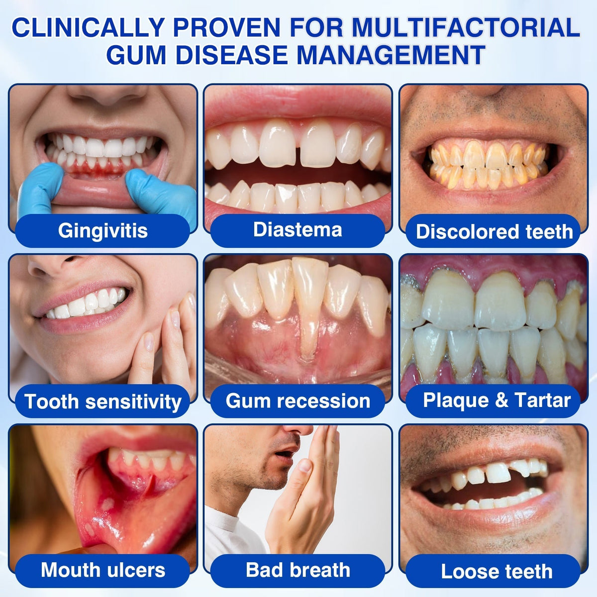 🇬🇧👩‍⚕️🦷😊Evolvion® GumRevive Periodontal Repair Gel🛡️✨