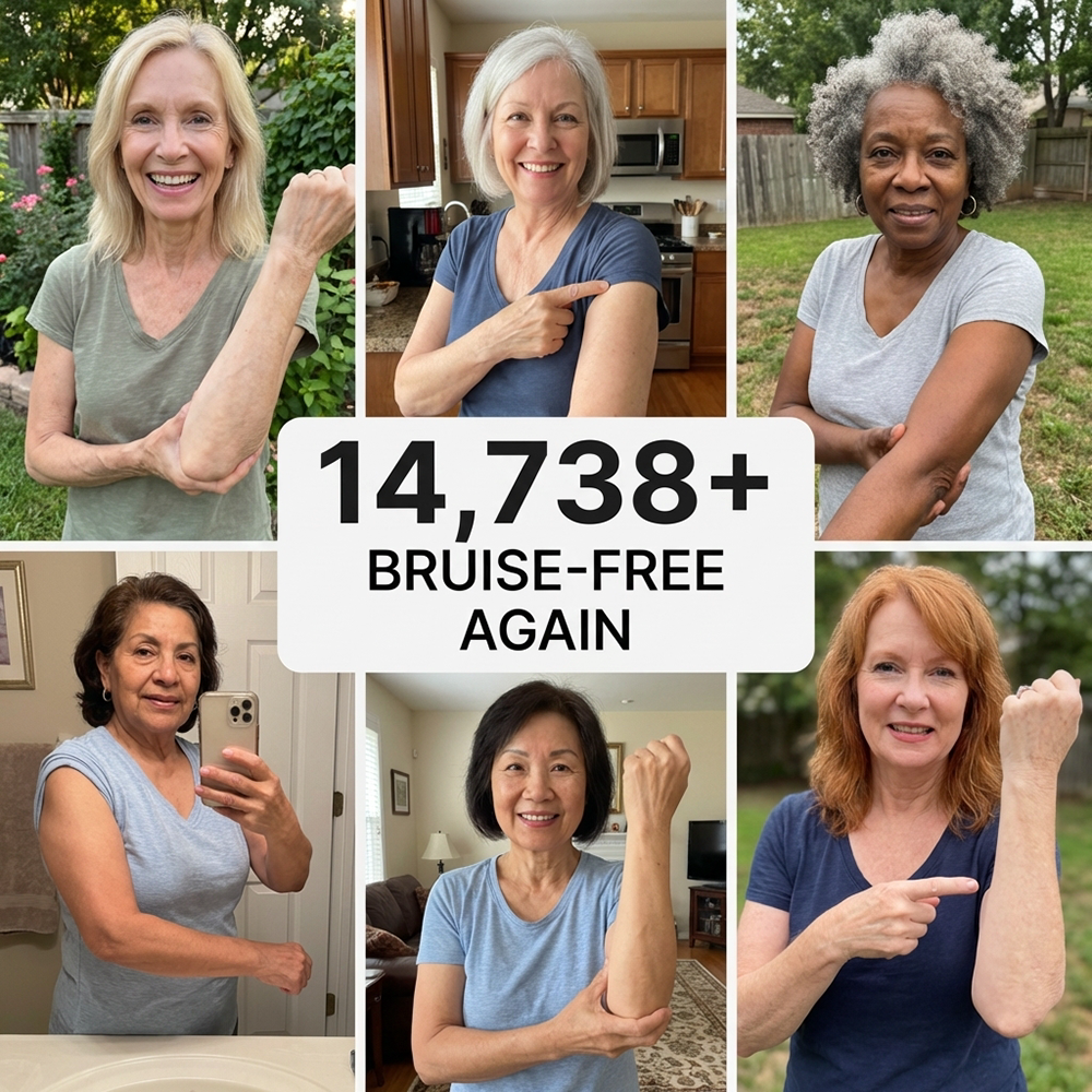 💕 2026 Best-Selling Skin Care | Rolimey® Bruise Care Cream | Advanced Care for Fragile, Aging & Bruise-Prone Skin