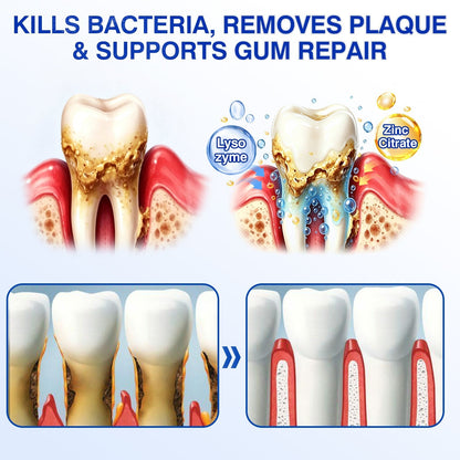 🇬🇧👩‍⚕️🦷😊Evolvion® GumRevive Periodontal Repair Gel🛡️✨