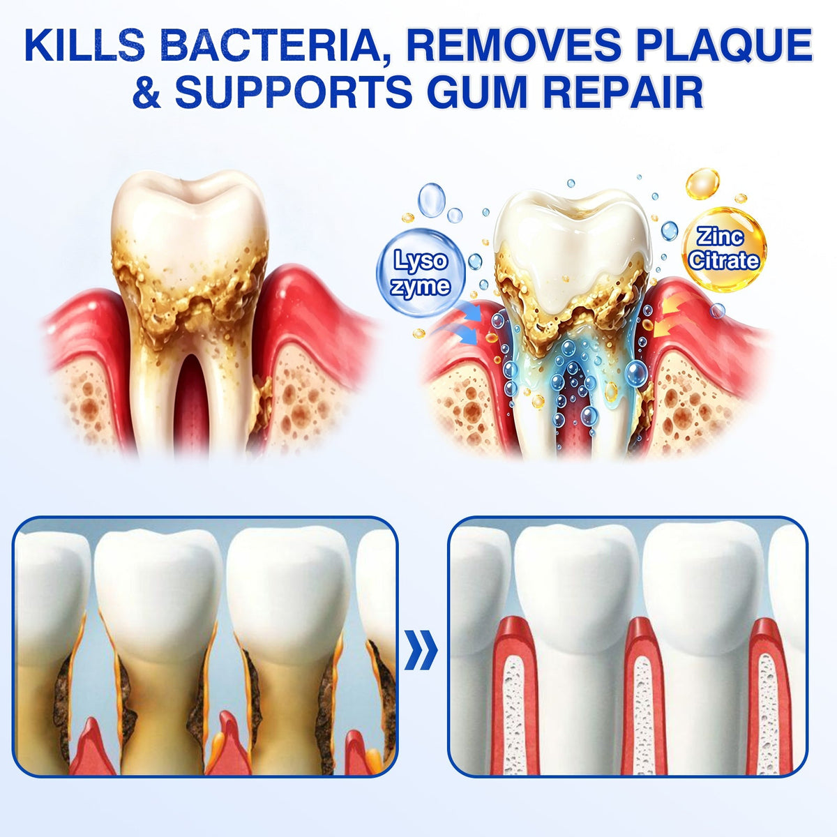 🎁🦷GumRevive Periodontal Repair Gel🛡️