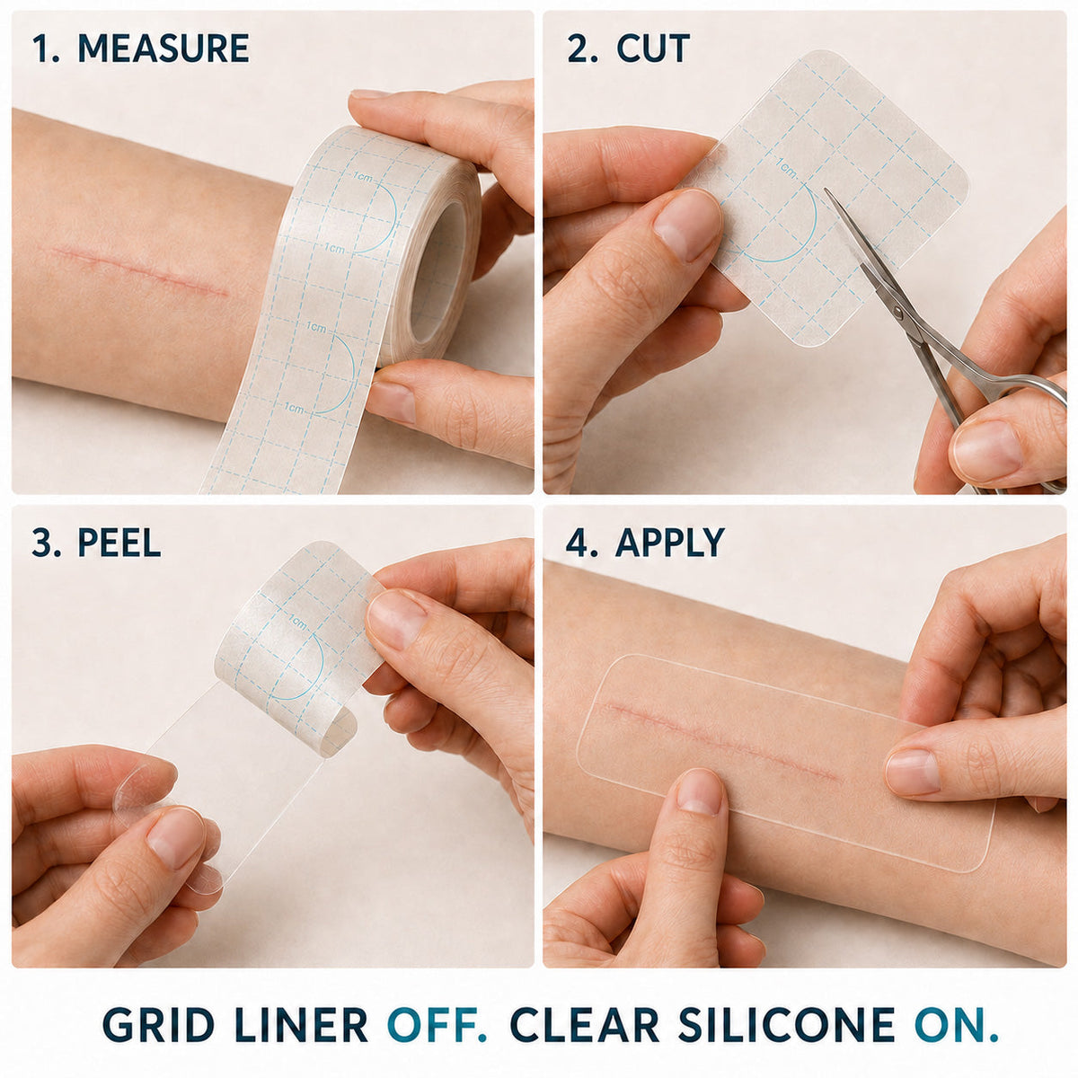 💖🎁TRILUMIA® SILICONE SCAR THERAPY ROLL  Help Soften, Flatten & Improve the Appearance of Raised Scars