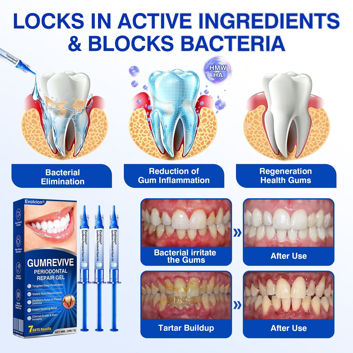🎁🎁30% OFF for GumRevive Periodontal Repair Gel🛡️