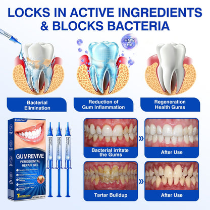 🎁🎁30% OFF for GumRevive Periodontal Repair Gel🛡️