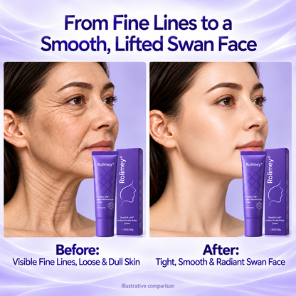 🎁💜Rolimey® Collagen Fullerene Cream, Rolimey Collagen Cream with Collagen Peptides, 2026 New Tighten & Lift Cream for Crepey Skin, Wrinkles and Tightening for Skin Types