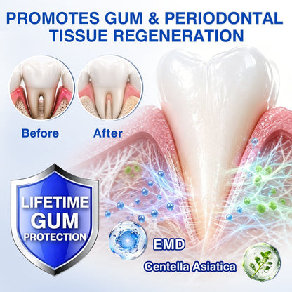 🎁🎁30% OFF for GumRevive Periodontal Repair Gel🛡️