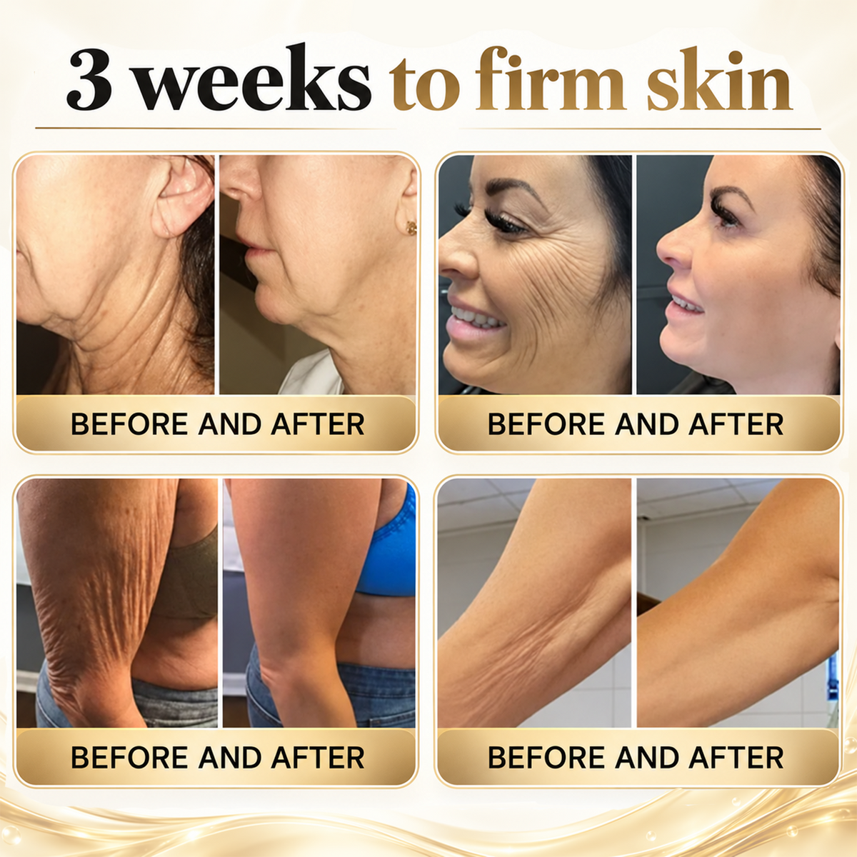 🎁2026 New Rolimey® Retinol Advanced Skin Restoration Cream | Botox-Inspired Firming & Smoothing Care for All Skin Types