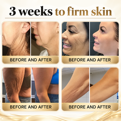 🎁2026 New Rolimey® Retinol Advanced Skin Restoration Cream | Botox-Inspired Firming & Smoothing Care for All Skin Types