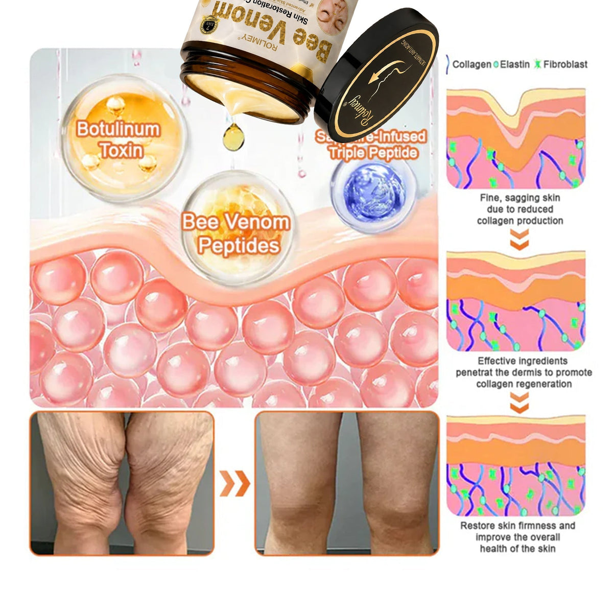 🎁💎 Rolimey® Bee venom Pro Comprehensive Cream —Tightening for Skin Types 🔥