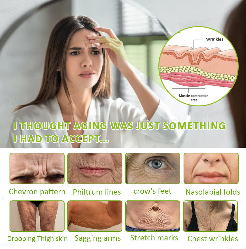 🍈Rolimey® Botox & Vita-A Retinol Shot Wrinkle-Lift Tightening cream - Last Day Promotion 70% OFF