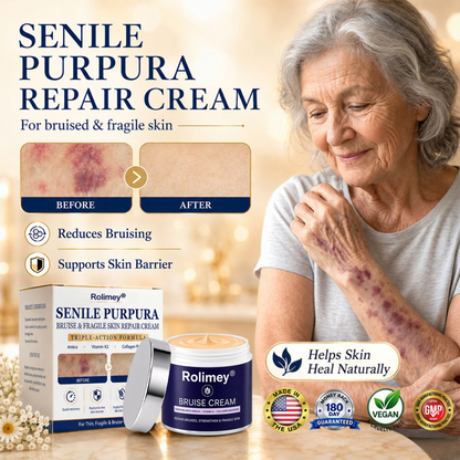 💕 2026 Best-Selling Skin Care | Rolimey® Bruise Care Cream | Advanced Care for Fragile, Aging & Bruise-Prone Skin