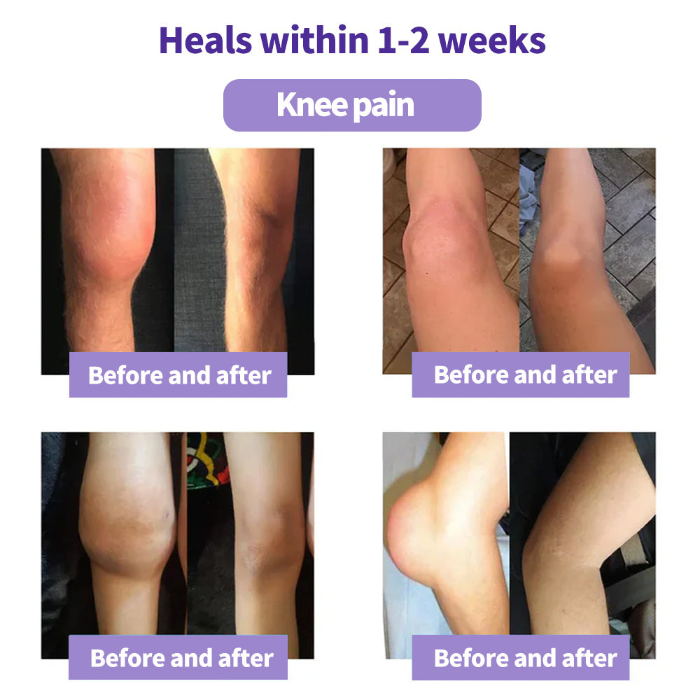 👨‍⚕️🦴Rolimey® Turmeric & Emu Oil Arthritis Soothing Pain Relief Massage Gel🛡️