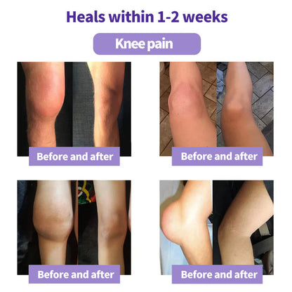 👨‍⚕️🦴Rolimey® Turmeric & Emu Oil Arthritis Soothing Pain Relief Massage Gel🛡️