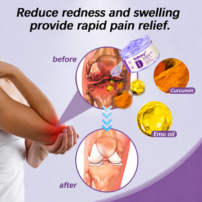 👨‍⚕️🦴Rolimey® Turmeric & Emu Oil Arthritis Soothing Pain Relief Massage Gel🛡️
