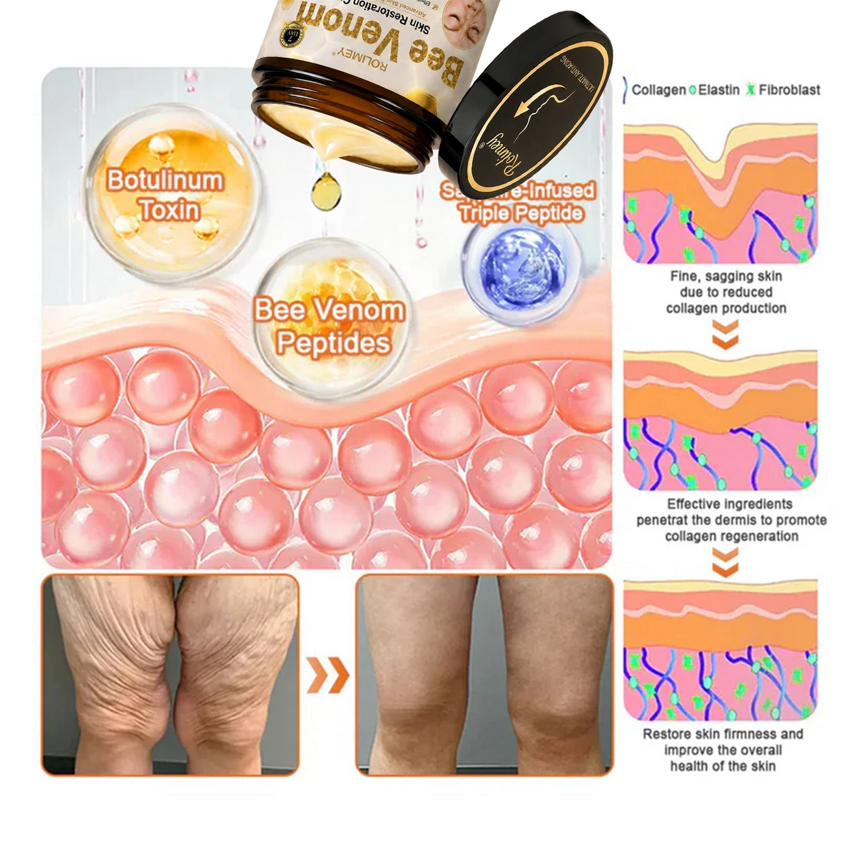 🇦🇺🌟💎 Rolimey® Bee venom Pro Comprehensive Cream —Tightening for Skin Types 🔥