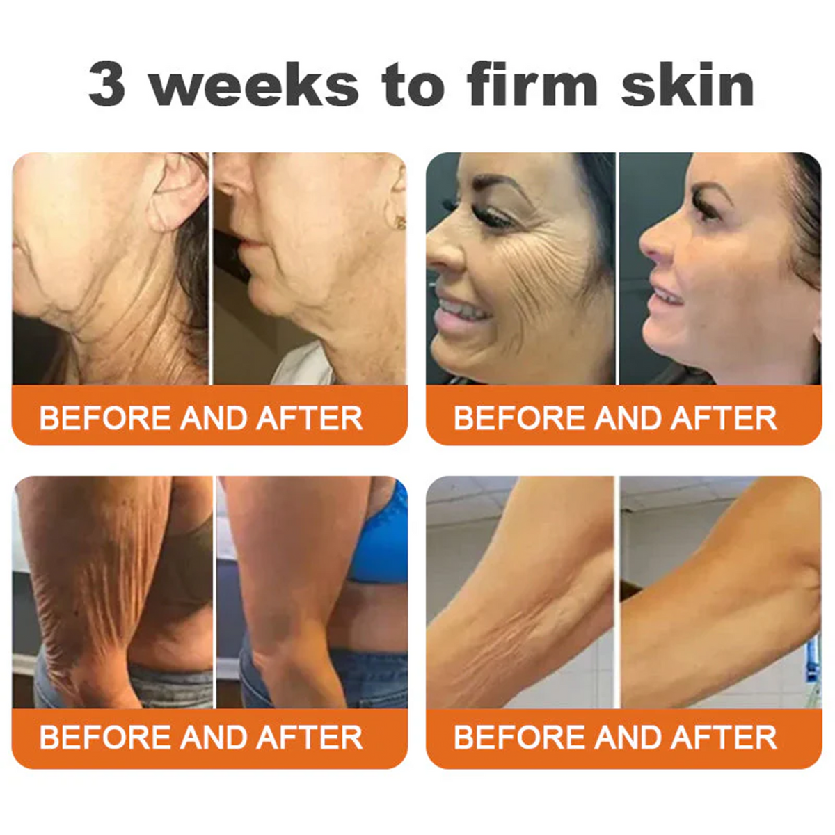 👨‍⚕️👨‍⚕️: Bee Venom · Botox Advanced Skin Rescue — Specifically Formulated for Paper-Thin, Fragile & Easy-Bruising Skin