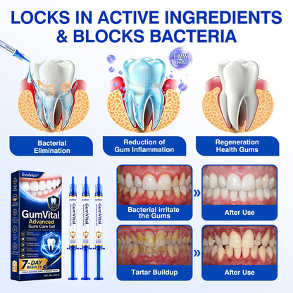 🇺🇸👨‍⚕️🦷😁Evolvion® GumRevive Periodontal Repair Gel🛡️✨