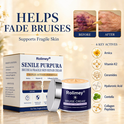 💕 2026 Best-Selling Skin Care | Rolimey® Bruise Care Cream | Advanced Care for Fragile, Aging & Bruise-Prone Skin