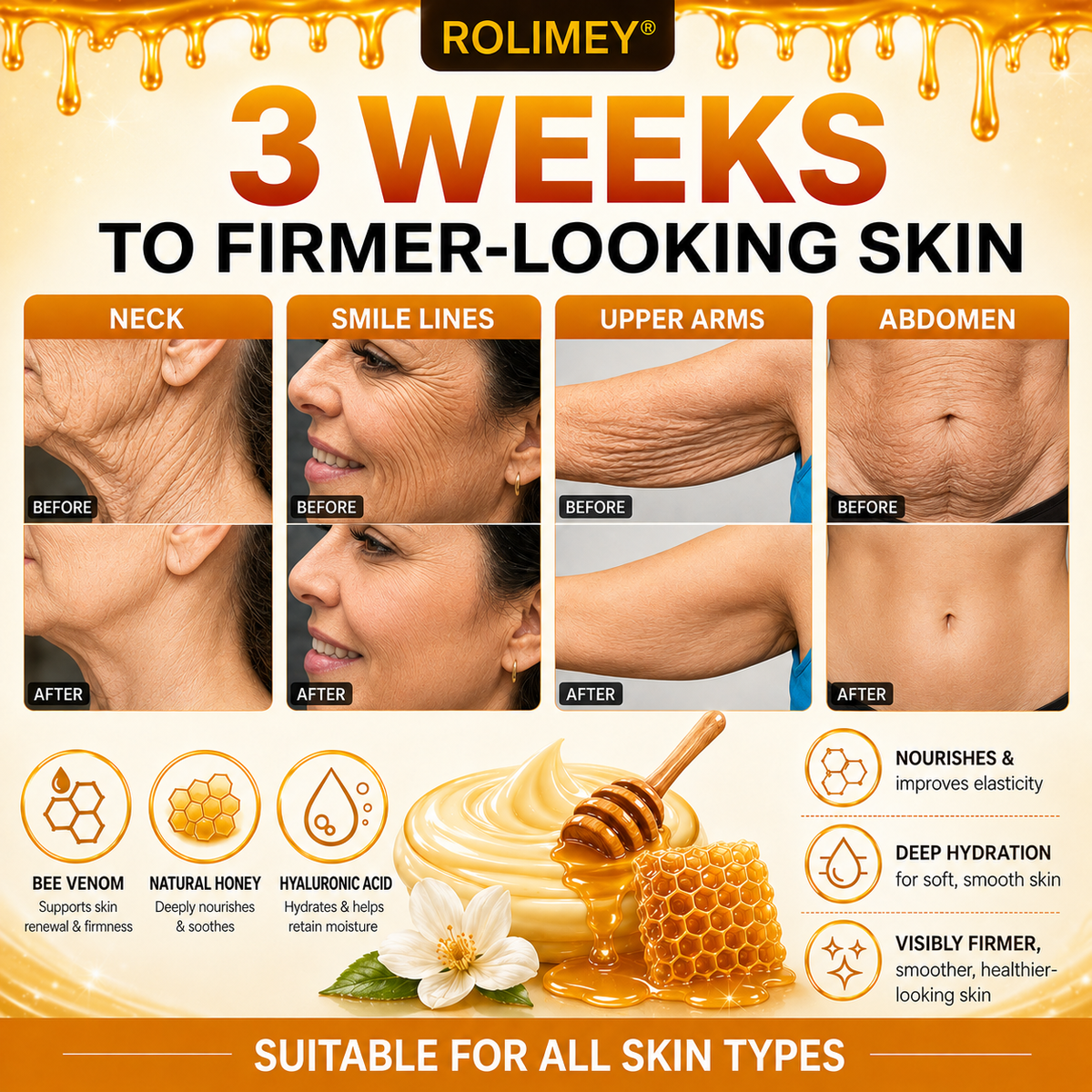🌟💎2026 New Rolimey® Bee Venom Advanced Skin Rescue Cream | Botox-Inspired Firming & Smoothing Care for All Skin Types